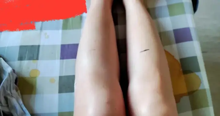 未婚美女长期吃避孕药不良后果，让你后背发凉！