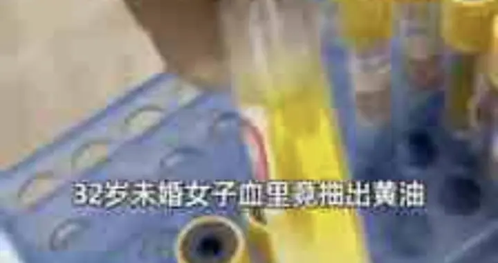 32岁女子血里抽出“黄油”？