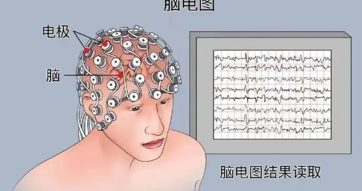 我能确诊癫痫吗？