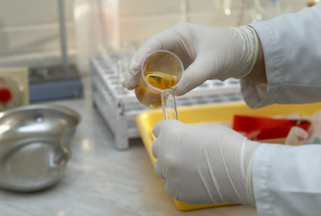 肾不好的人，身上会有“两黑一臭”！不想肾提前报废，做好4件事