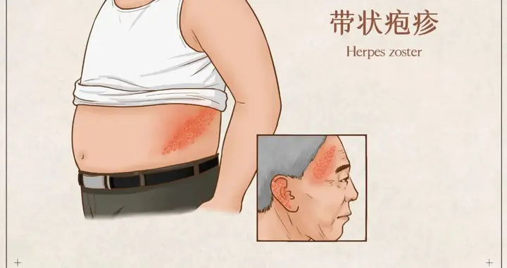 45岁蔡依林自曝患病经历，这病毒一旦感染终身携带，剧痛无比！