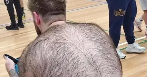 体毛多就是雄性激素高？直白告诉您没半毛钱关系！