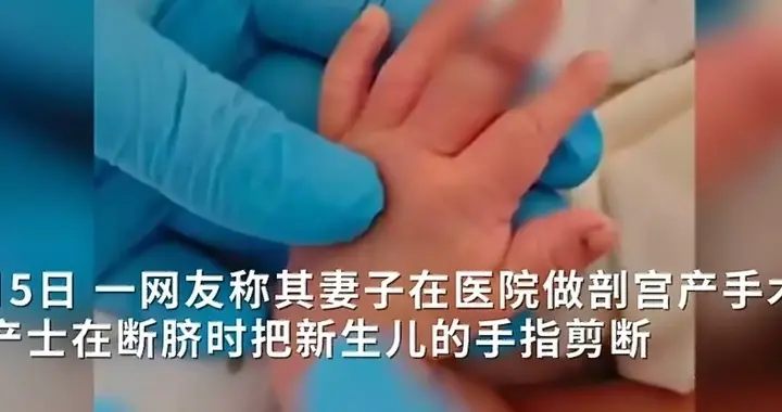 新生儿剪脐带时手指被意外剪断! 涉事医院两年涉14起纠纷, 官方介入