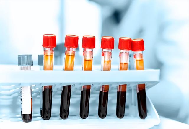 哪种血型容易老年痴呆?血型和痴呆之间真有关系吗?来看看研究结果