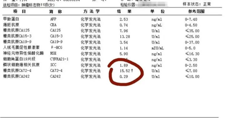 体检报告里这4项异常，竟是癌症信号？9成人不重视，后悔太晚！