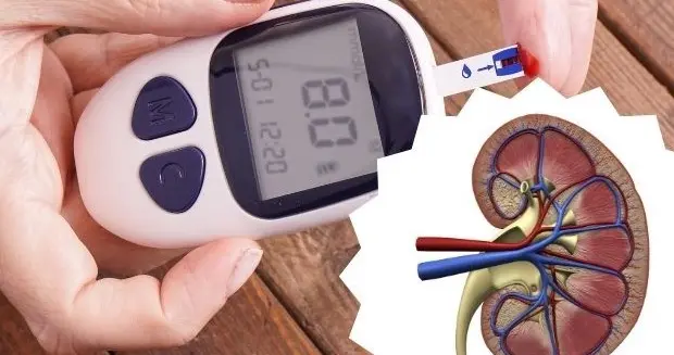 糖尿病肾病患者什么情况下需要肾活检？