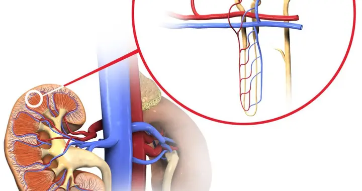 糖尿病尿蛋白3+一定是肾病吗？