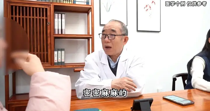 玫瑰痤疮怎么治？老中医：核心在治“症”