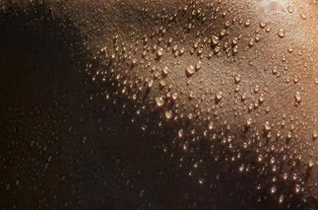 头上爱出汗，总是头发打湿？多是四个原因，中医教你强力止汗妙招