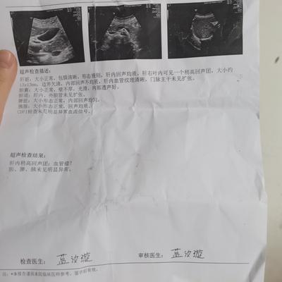 小小：保住胆囊了 保住胆囊了 保住胆囊了