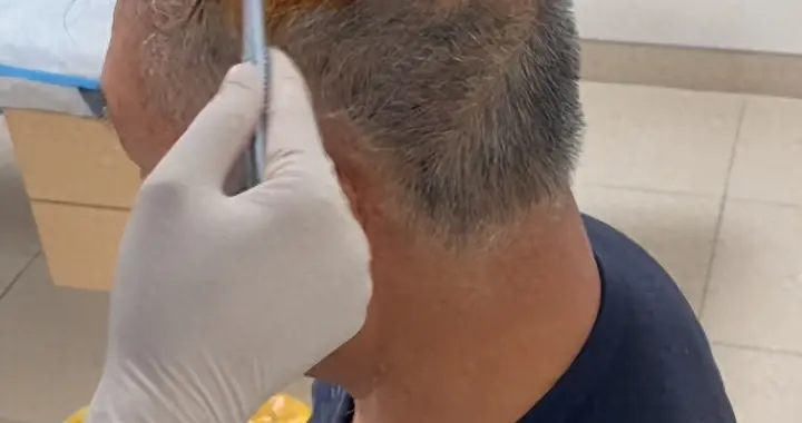 七旬游客夫妇被民宿屋顶掉下的瓦片砸中，双双头部受伤流血，索赔6000余...