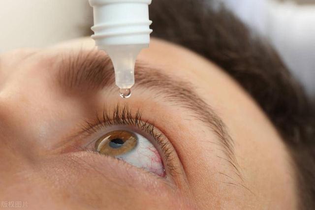 眼睛干涩就滴眼药水？上海眼科院长：滥用可能引起白内障等眼病