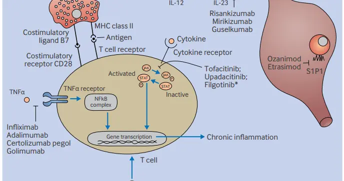 BMJ：炎症性肠病最新药物治疗进展，一文汇总丨高分综述