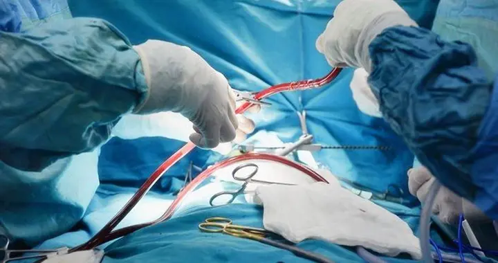 心脏支架术后复查，心内科主任：一定记住这3个关键指标