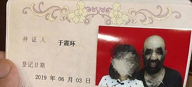 那年轰动一方的“毛孩”：42岁娶90后小娇妻，生儿有遗传？