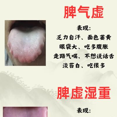 正能量的刘医生：脾胃虚弱的辨证思路：气虚