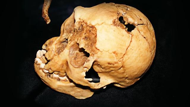 矮小类人猿之谜：弗洛勒斯人为何如此娇小？