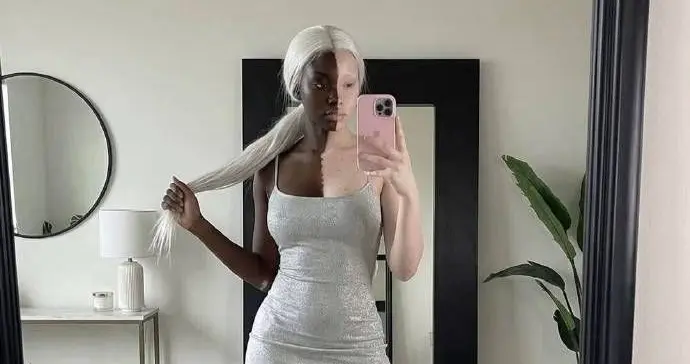 严重怀疑这个黑人妹子白癜风的真实性