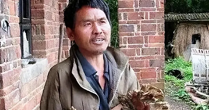 2016年，湖南男子患树人综合征，身体长出树瘤，后来咋样了？