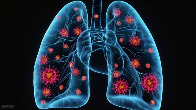 肺癌和吸烟有关系吗