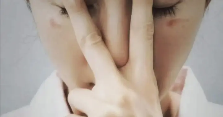 杨幂踩雷！蒸汽眼罩竟致低温烫伤，90%的人都在用错