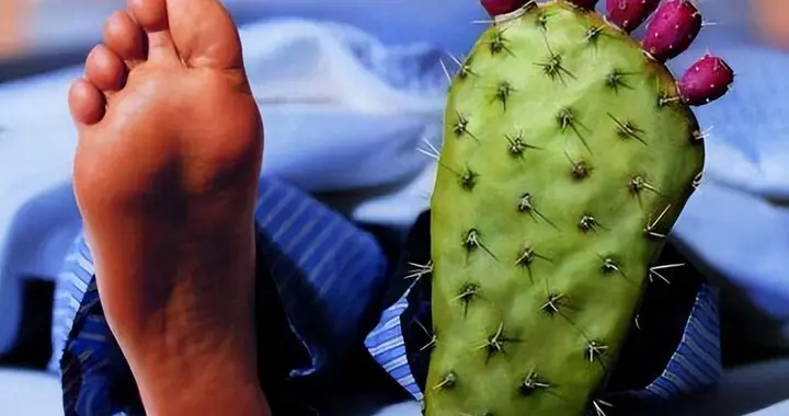 痛风不只是吃出来的痛，6个习惯也容易中招，年轻人也要做好预防