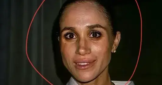 心疼哈里王子！梅根近照不成样子，抗癌的凯特王妃状态更好！