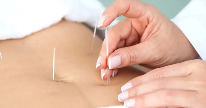 针灸疼到飙泪才管用？这3个真相，爱“被扎”的人一定要收藏