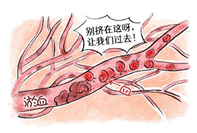 肝郁气滞＋瘀血，到底多难调？中医一“通” 气血充盈，标本兼治！