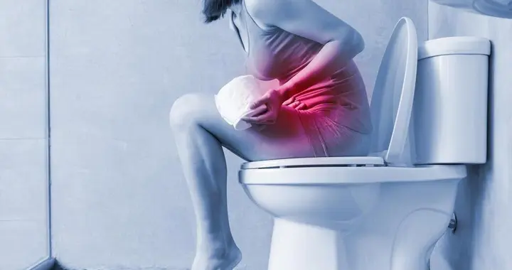 20年,55岁女子每天大便两三次,肠镜检查正常,直到换了科室确诊