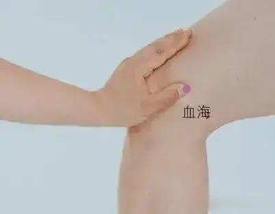 麒麟针揭秘：针刺血海穴如何治荨麻疹？从病因到操作全解析