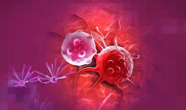 体内有癌，“腿部”先知？提醒：若腿上有4个异样，建议尽早检查