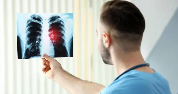 医生发现：天天走路锻炼的肺癌患者，不用几个月，身体迎来5变化