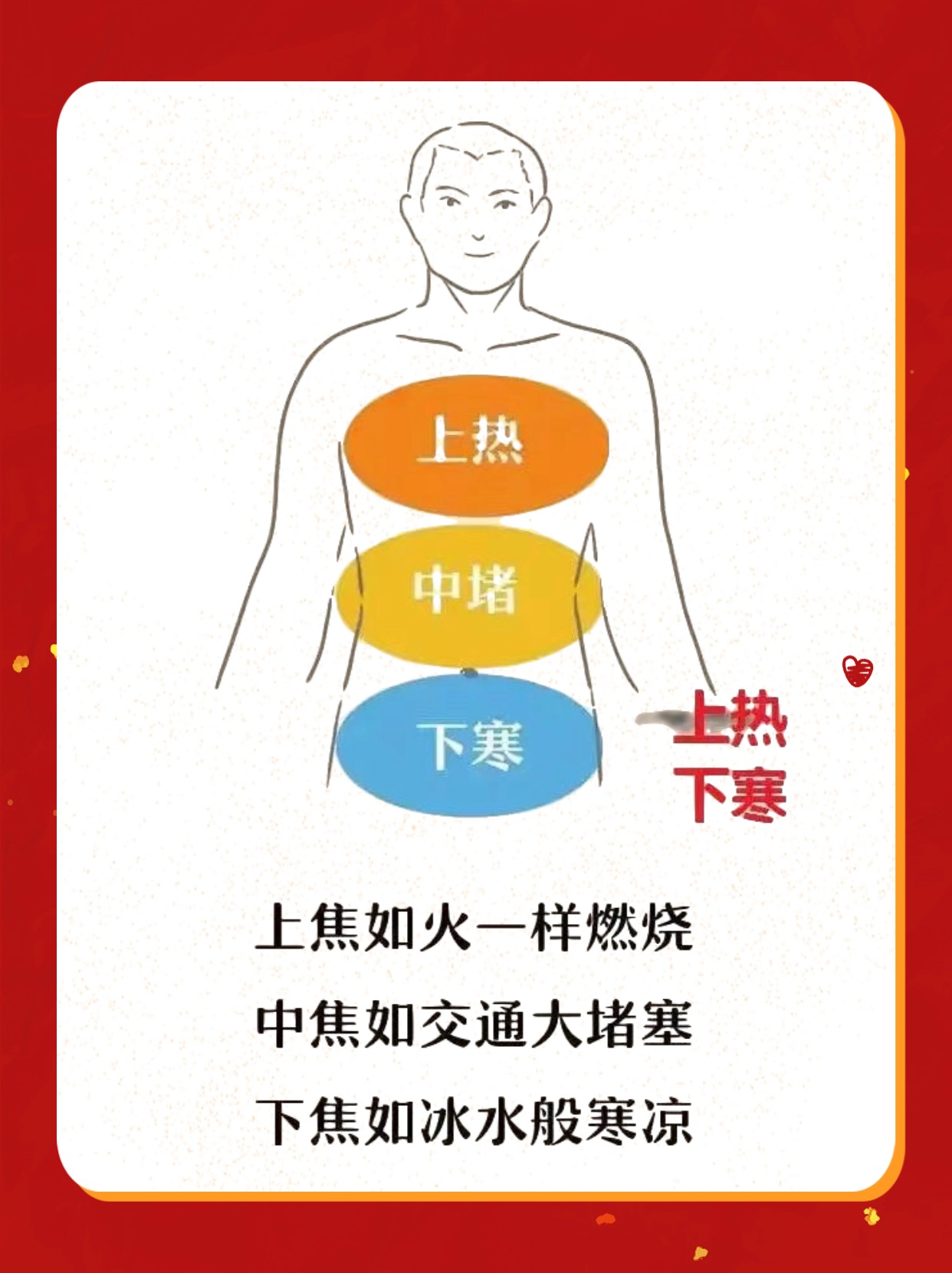 上热下寒怎么办？什么是上热下寒？