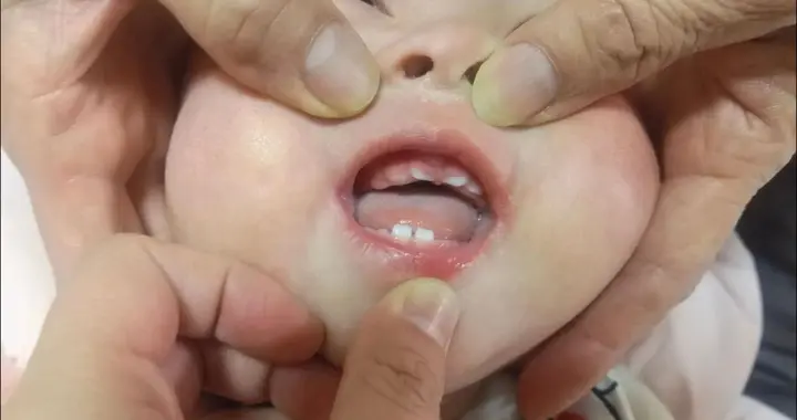 孩子一岁后“多吃饭”还是“多喝奶”，妈妈搞反白花钱娃还会变笨