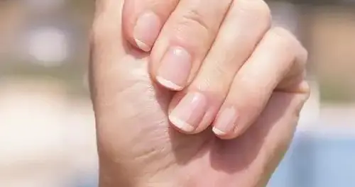 指甲月牙，用来判断阴阳气血状况