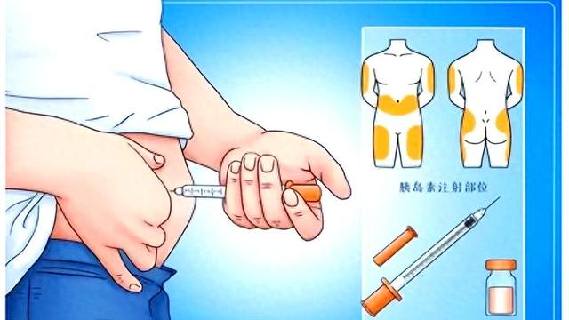 廉哥说事：朋友喝酒前先打胰岛素，现在我才