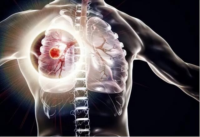 40年前就敢公开叫板西医，专收各大医院不收的癌症病人，他是谁