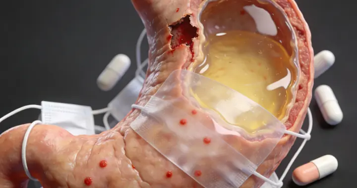 胃黏膜破损，疼痛越频，一个胃药，把屏障筑牢了，胃就不痛了！