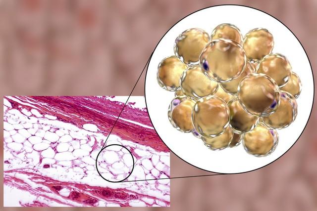 人工合成的“垃圾食品”排行榜公布，第一名很多人每天都在吃