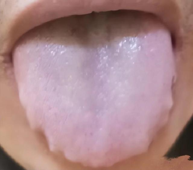 参苓白术散虽好，但不适合这几种人！