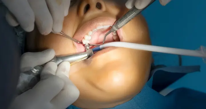 先打“地基”、再上螺丝，种牙完整过程太神奇了