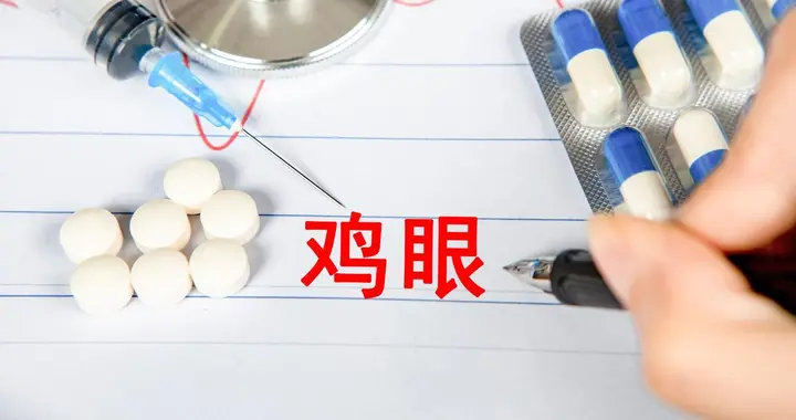 根治脚鸡眼不难：选对治疗方法，配合日常防护，一步到位