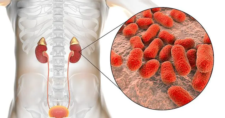 怎么能查出隐匿性肾炎？