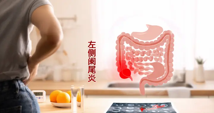 肚子左边疼也是阑尾炎？这个“迷路”的器官险些误了大事