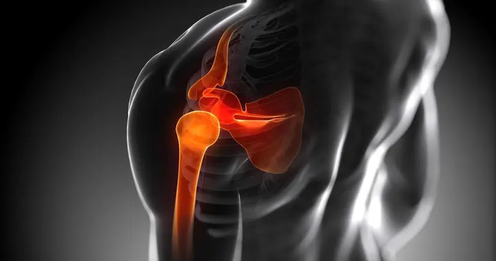 你的站姿透露了什么？一个简单观察，及早发现肩部问题