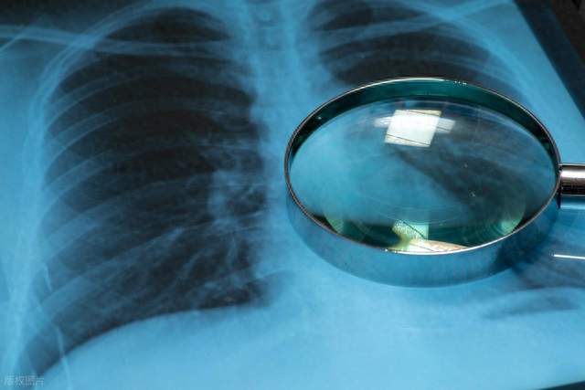 生活方式对预防肺癌有哪些积极意义？