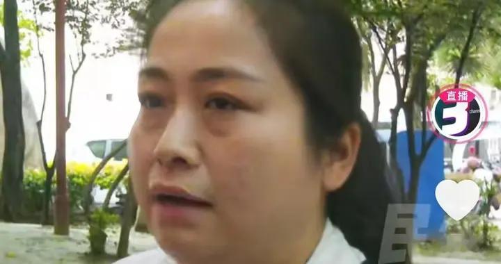 醉酒物业经理当街施暴！6旬大妈被打成脑震荡，警方已立案