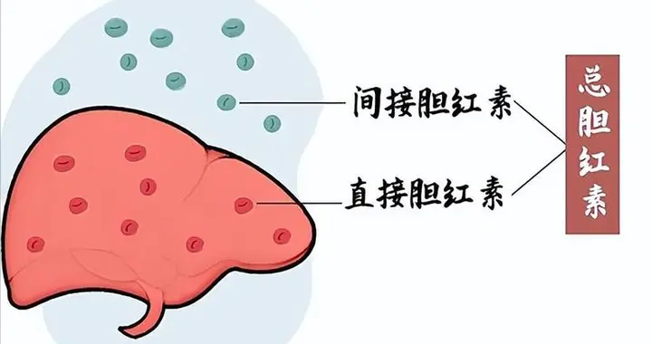 研究发现：只要胆红素没超过这个值，不要过度吃药，别继续吓自己