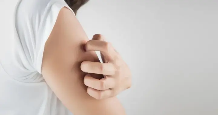 皮肤瘙痒以为是过敏，一查竟是癌症！身体这些部位瘙痒一定要注意→